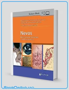 Nevos Tumores Neviformes y Sindromes Nevicos (Spanish Edition) (High Quality Image PDF)