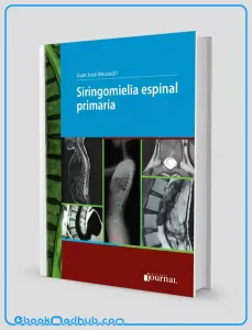 Siringomielia espinal primaria (High Quality Image PDF)