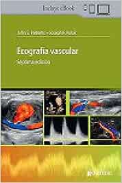 Ecografía Vascular