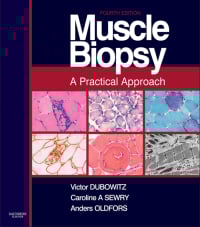 Muscle Biopsy A Practical Approach