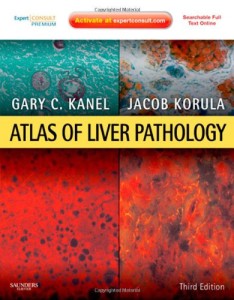 Atlas of Liver Pathology Expert Consult