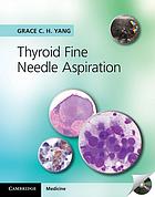 Thyroid Fine Needle Aspiration