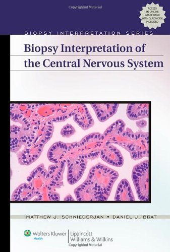 Biopsy Interpretation of the Central