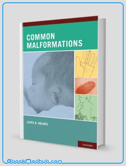 Common Malformations