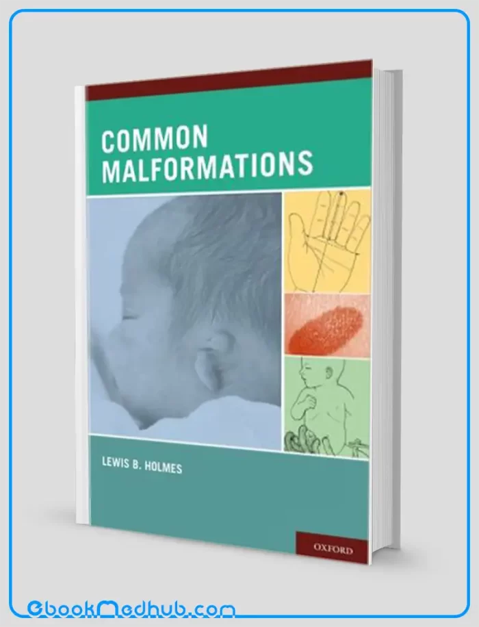 Common Malformations