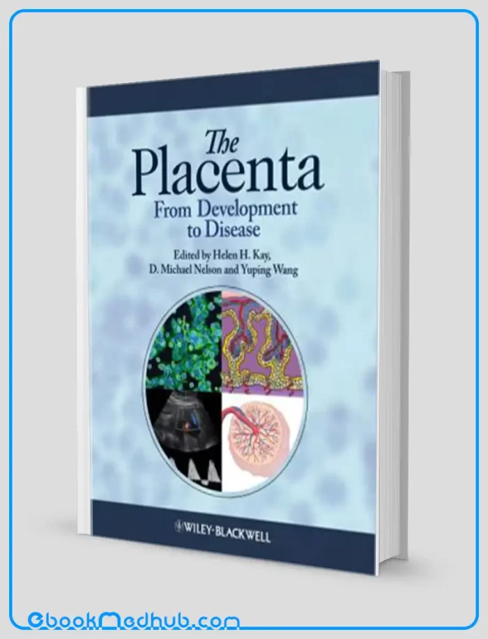 The Placenta From Development to Disease