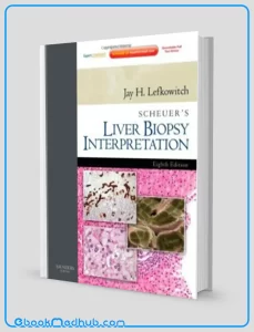 Scheuers Liver Biopsy Interpretation 8e (Original PDF from Publisher)