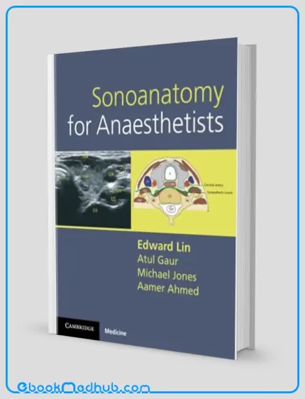 Sonoanatomy for Anaesthetists