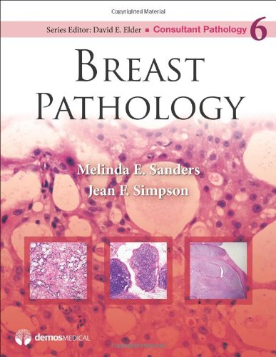 Breast Pathology Consultant Pathology