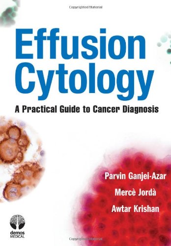 Effusion Cytology A Practical Guide