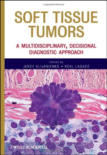 Soft Tissue Tumors A Multidisciplinary