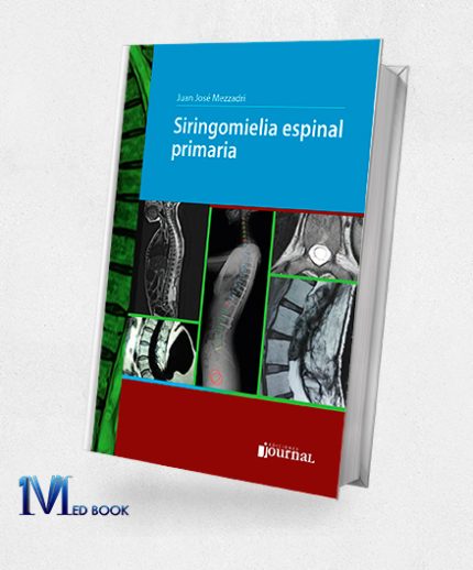 Siringomielia espinal primaria (High Quality Image PDF)