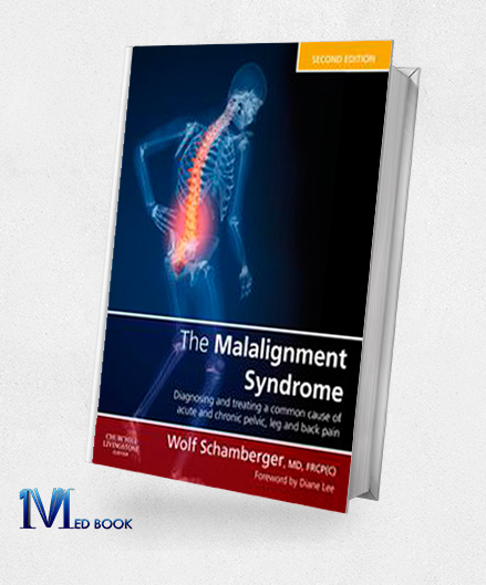 The Malalignment Syndrome diagnosis and treatment of common pelvic and ...