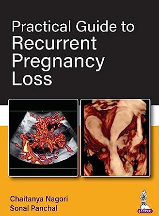 Practical Guide to Recurrent Pregnancy