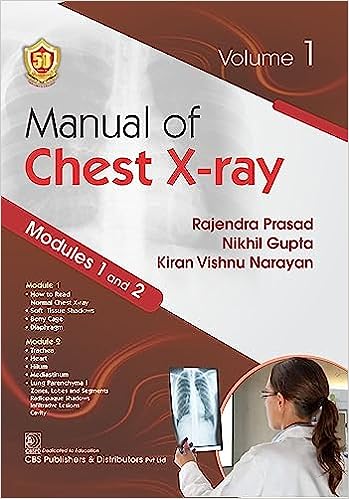 Manual of Chest X ray volume 1