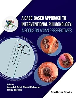 A Case Based Approach to Interventional
