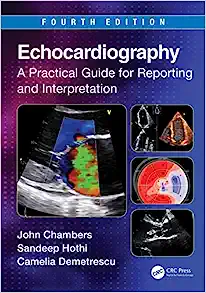 Echocardiography A Practical Guide