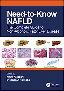 Need to Know NAFLD The Complete Guide