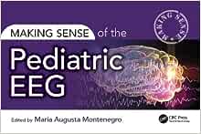 Making Sense of the Pediatric EEG