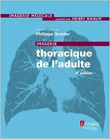 Imagerie Thoracique De Ladulte