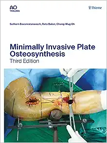 Minimally Invasive Plate
