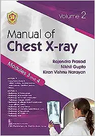 Manual of Chest X ray Volume 2