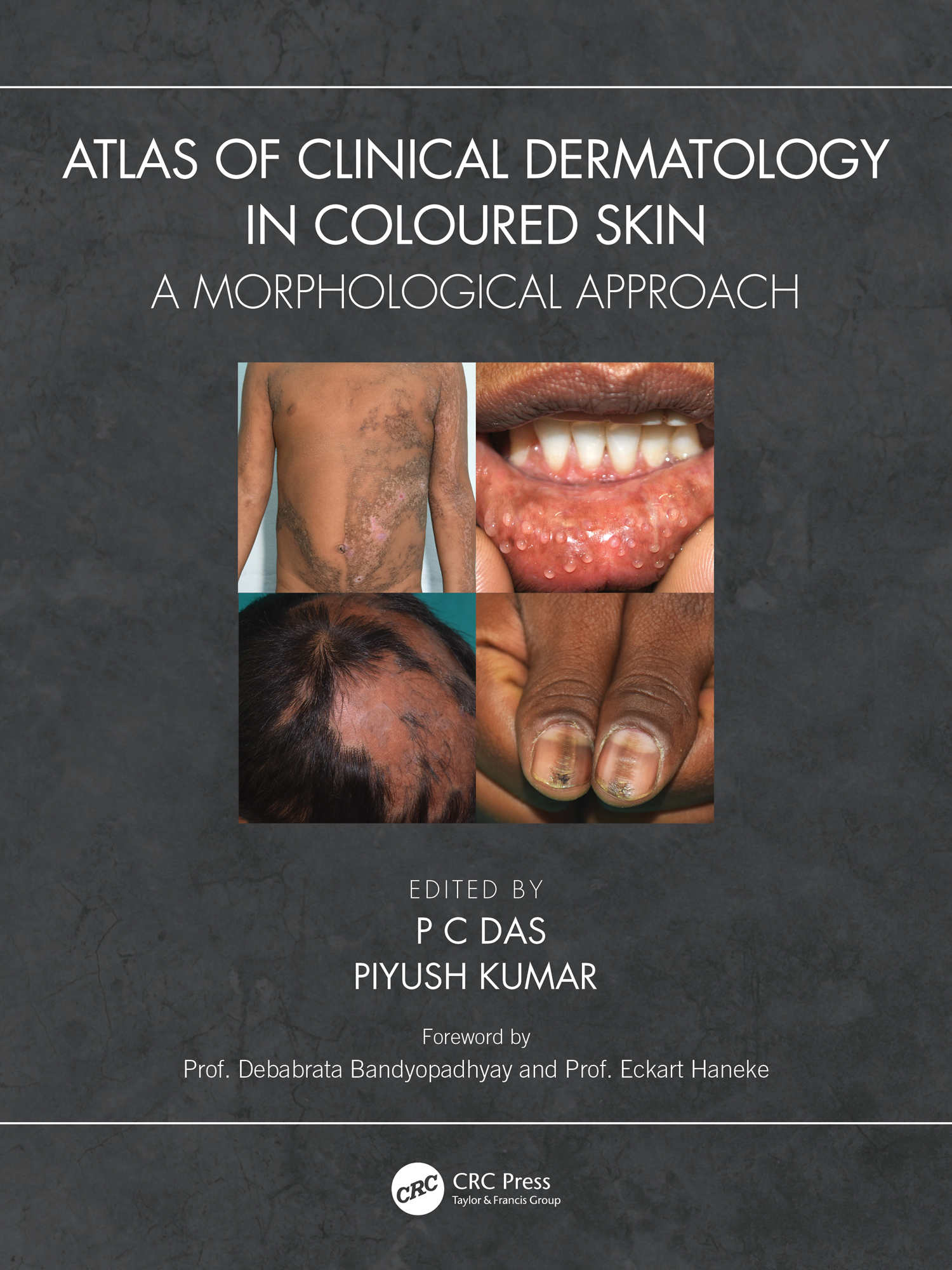 Atlas of Clinical Dermatology
