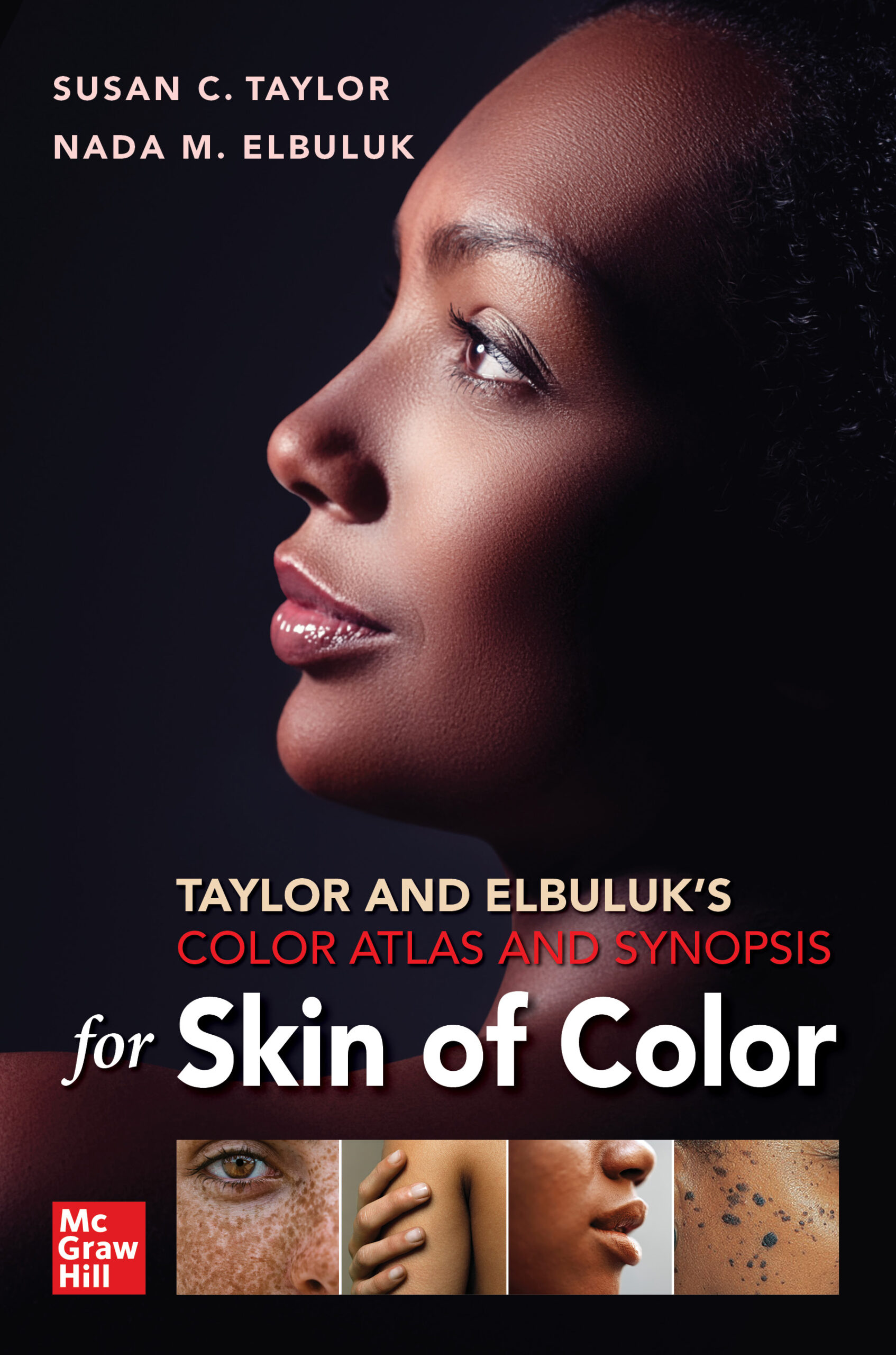 color atlas and synopsis for Skin of Color