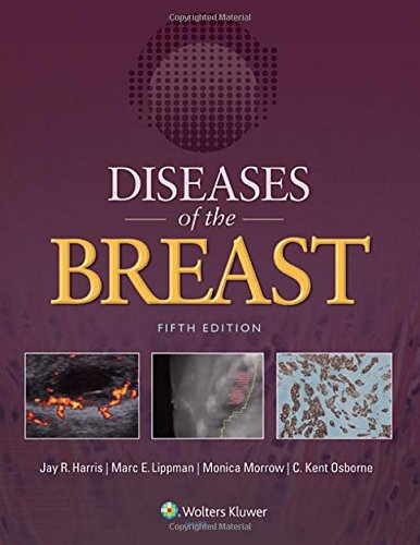 Diseases of the Breast