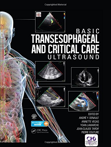Basic Transesophageal and Critical Care