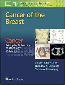 Cancer of the Breast