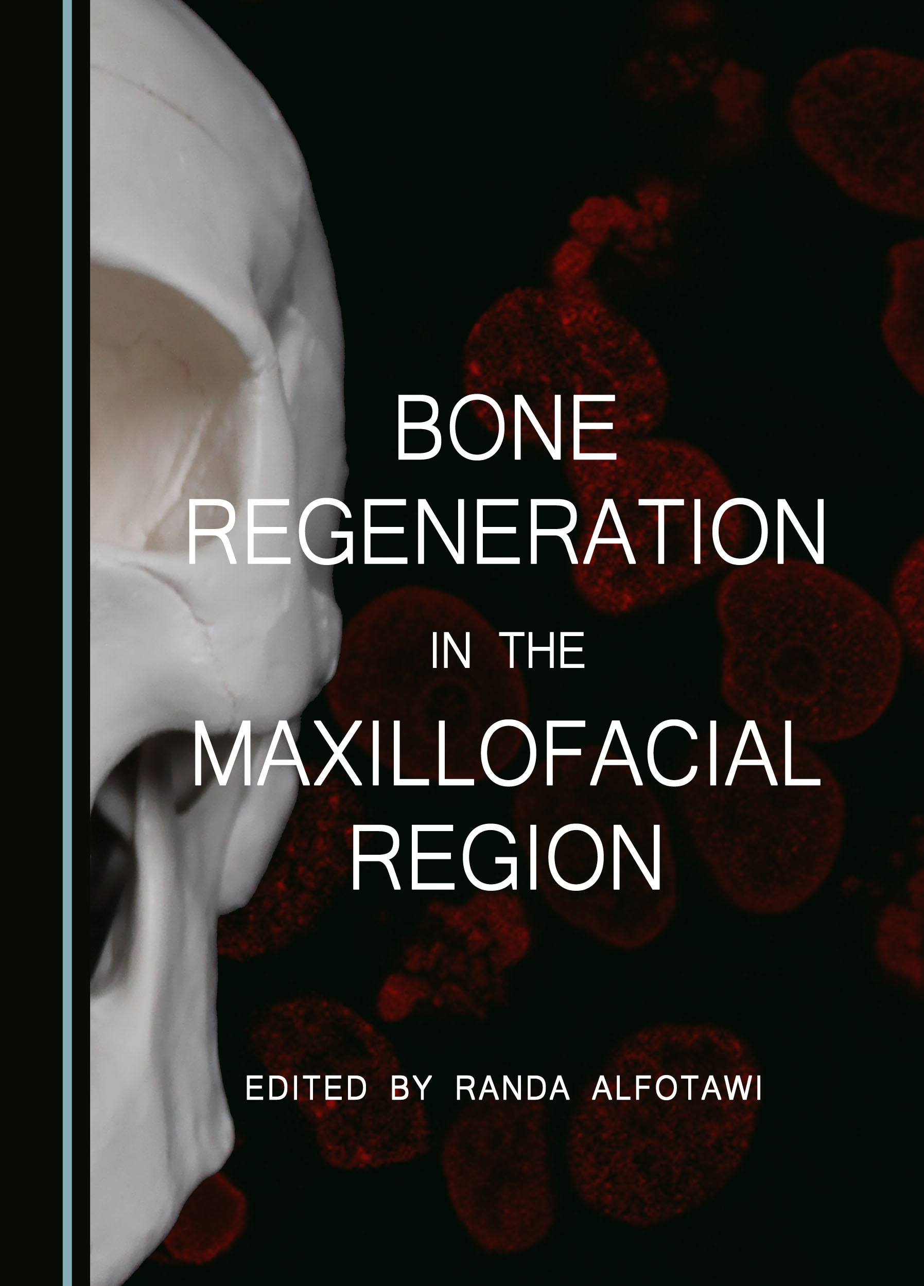 Bone Regeneration in the Maxillofacial