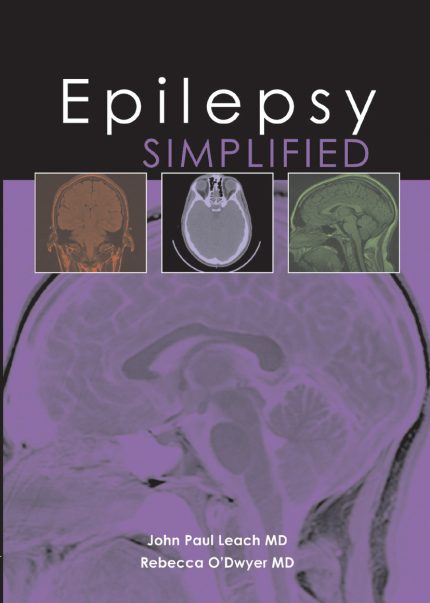 Epilepsy Simplified