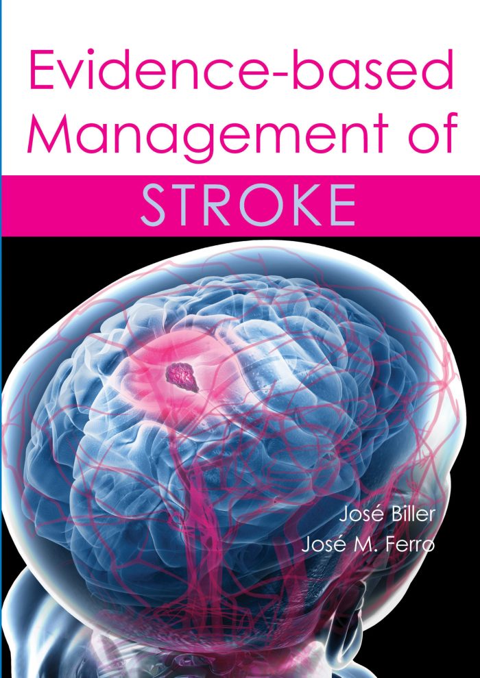 Evidence based Management of Stroke