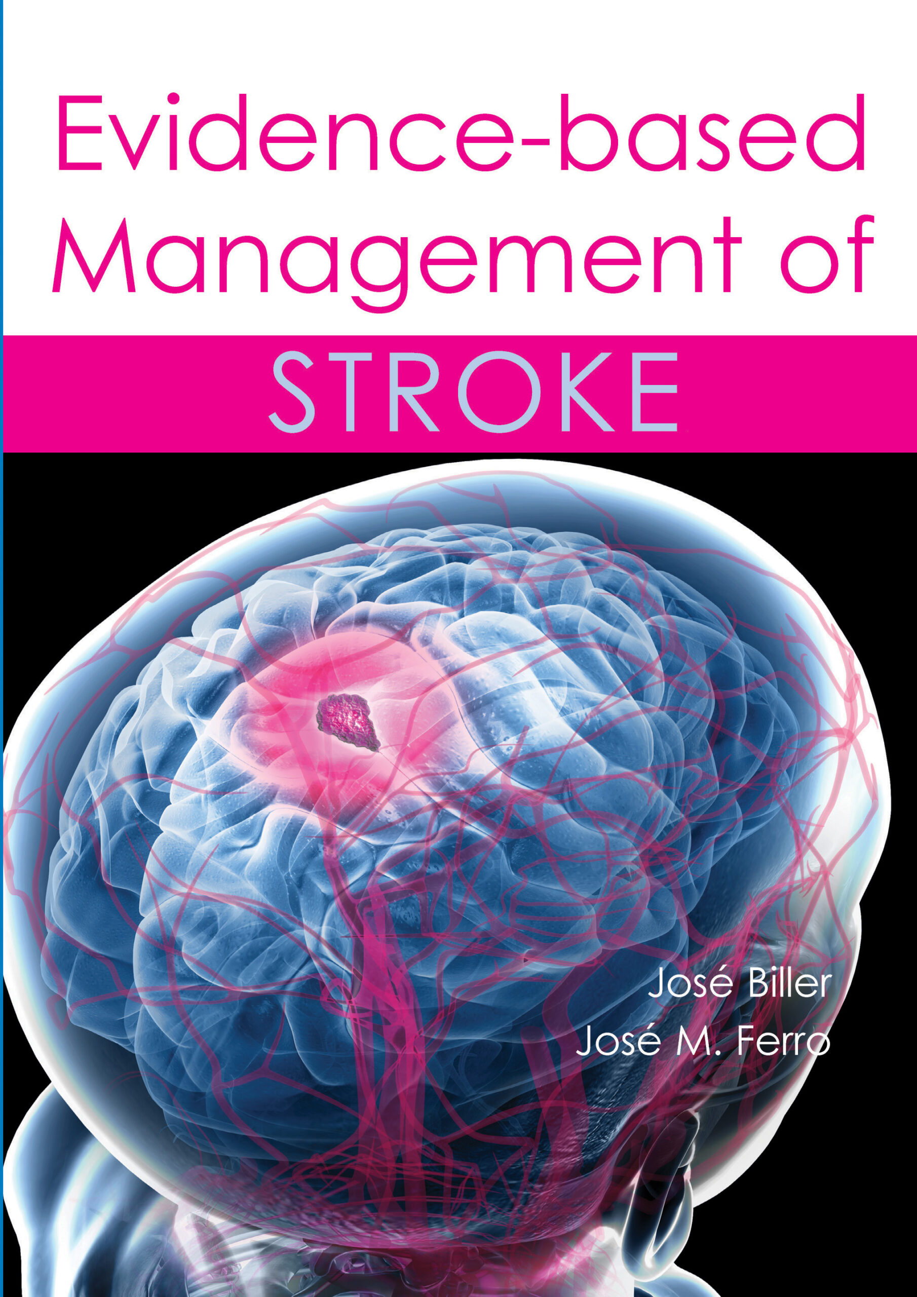 Evidence based Management of Stroke