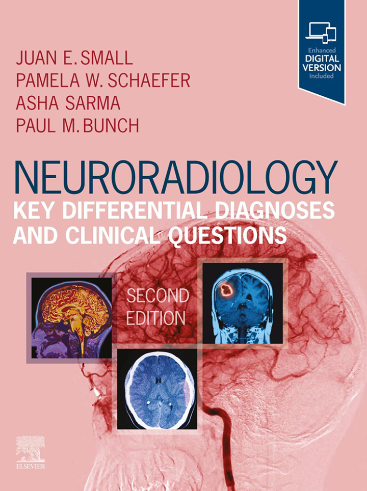 Neuroradiology Key Differential Diagnoses