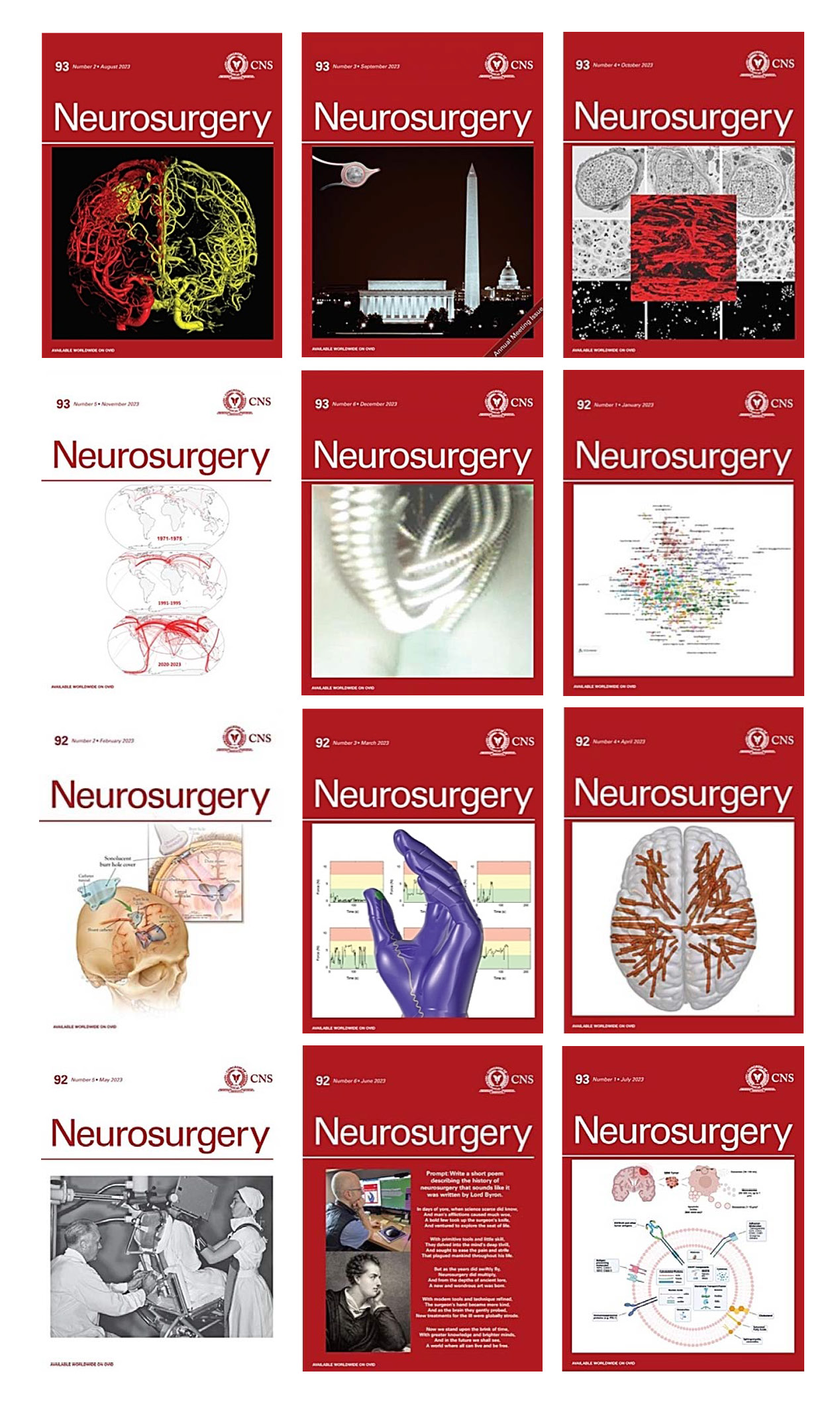 Neurosurgery 2023 Full Archives