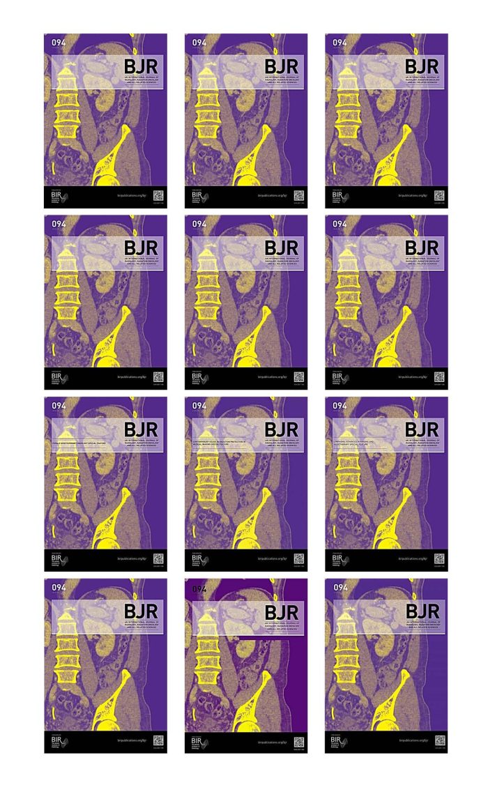 British Journal of Radiology 2021