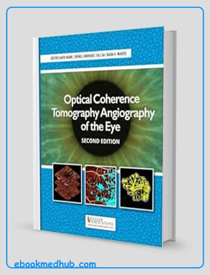 Optical Coherence Tomography Angiography Of The Eye, 2nd Edition (Converted PDF)