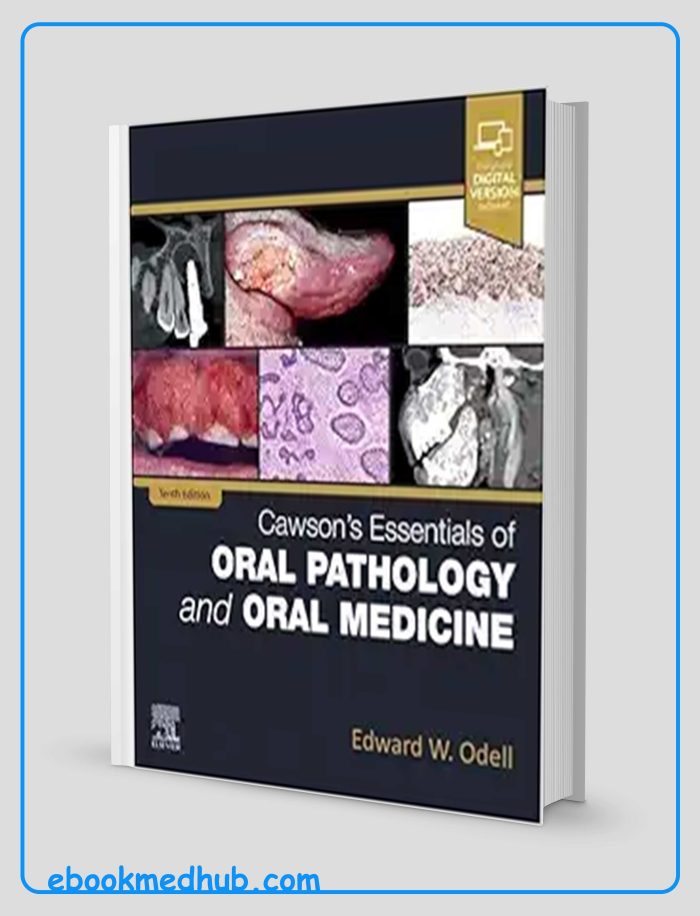 Cawson’s Essentials Of Oral Pathology And Oral Medicine, 10th Edition (True PDF)