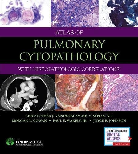 Atlas of Pulmonary Cytopathology (EPUB)