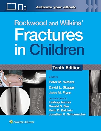 Rockwood and Wilkins Fractures in Children: Print + eBook with Multimedia
