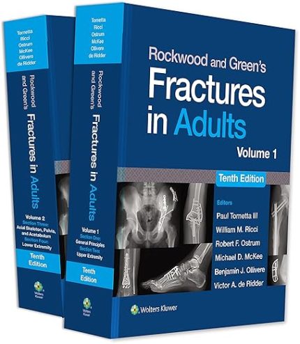 Rockwood and Greens Fractures in Adults